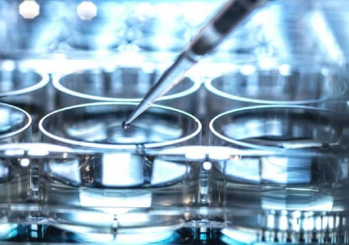 קונספירציה חדשה? עיתונאי אנונימי טוען: "יש אינדיקציה שהזן הנוכחי של אבעבועות הקופים בא ממעבדה, אולי באוקראינה"