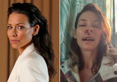 כוכבת 'אבודים' מעדכנת: "יש לי נזק מוחי"