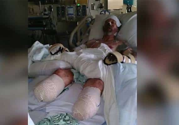 מחריד: עבר כריתת גפיים בעקבות ליקוקים מכלב