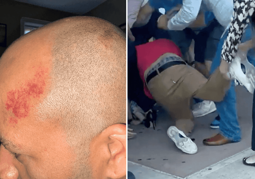 טקס הסיום שהפך לאלים: משפחה יהודית הותקפה פיזית על ידי משפחה פרו-פלסטינית 