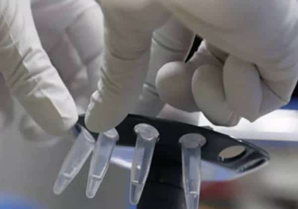 אוניברסיטה רוסית השלימה בהצלחה ניסוי ראשון בחיסון לקורונה