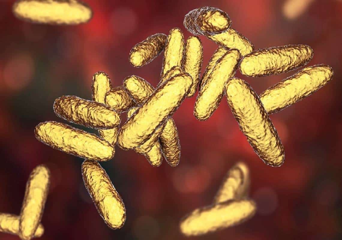 מחלת-מין טורפת-בשר חדשה הגורמת ל'פצעים אדומים' מתפשטת בקצב מהיר ברחבי בריטניה - האם תגיע לחופי ארה"ב?