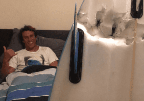 קליפורניה: גולש ננשך על ידי כריש והצליח להדוף אותו בבעיטות