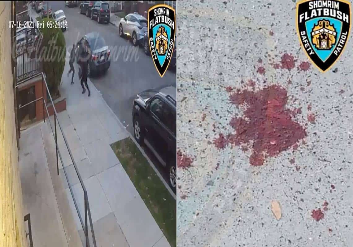 אנטישמיות אלימה: התפילין נגנבו מיהודי שהוכה עד זוב דם - ה-NYPD מבקש עזרת הציבור באיתור התוקף