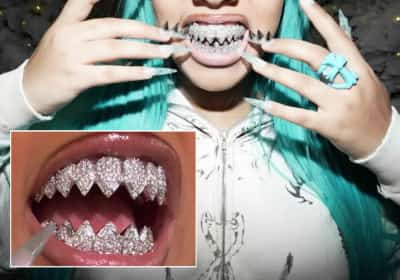 הגזימה? נורת' וסט עם חיוך חדש שמשובץ כולו ביהלומים