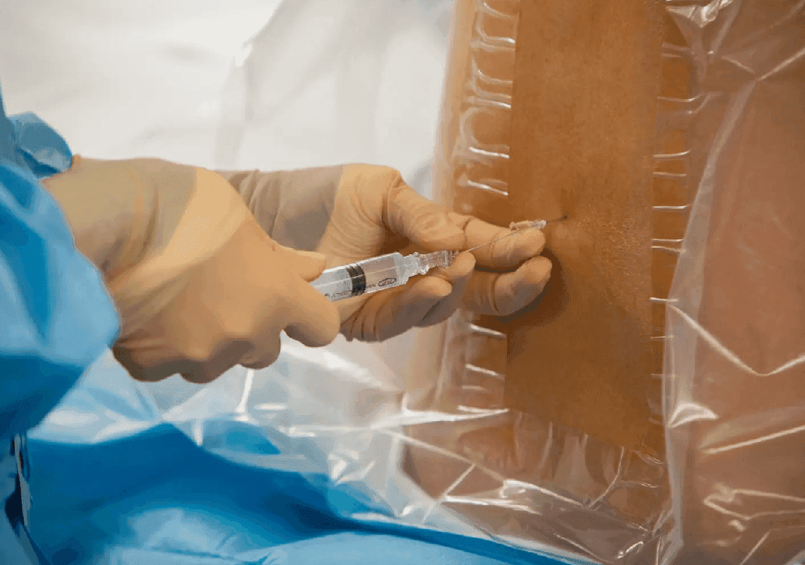 אמריקאי נוסף מת לאחר שעבר הליך רפואי במקסיקו