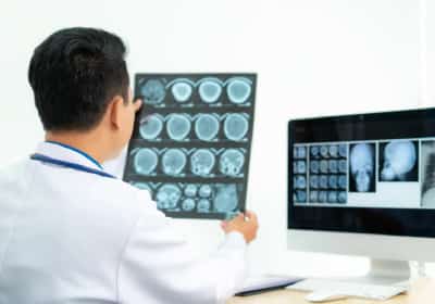 יותר אמריקאים מנצחים את הסרטן מאי פעם - אך שלושה סוגים ממשיכים להוביל בתמותה