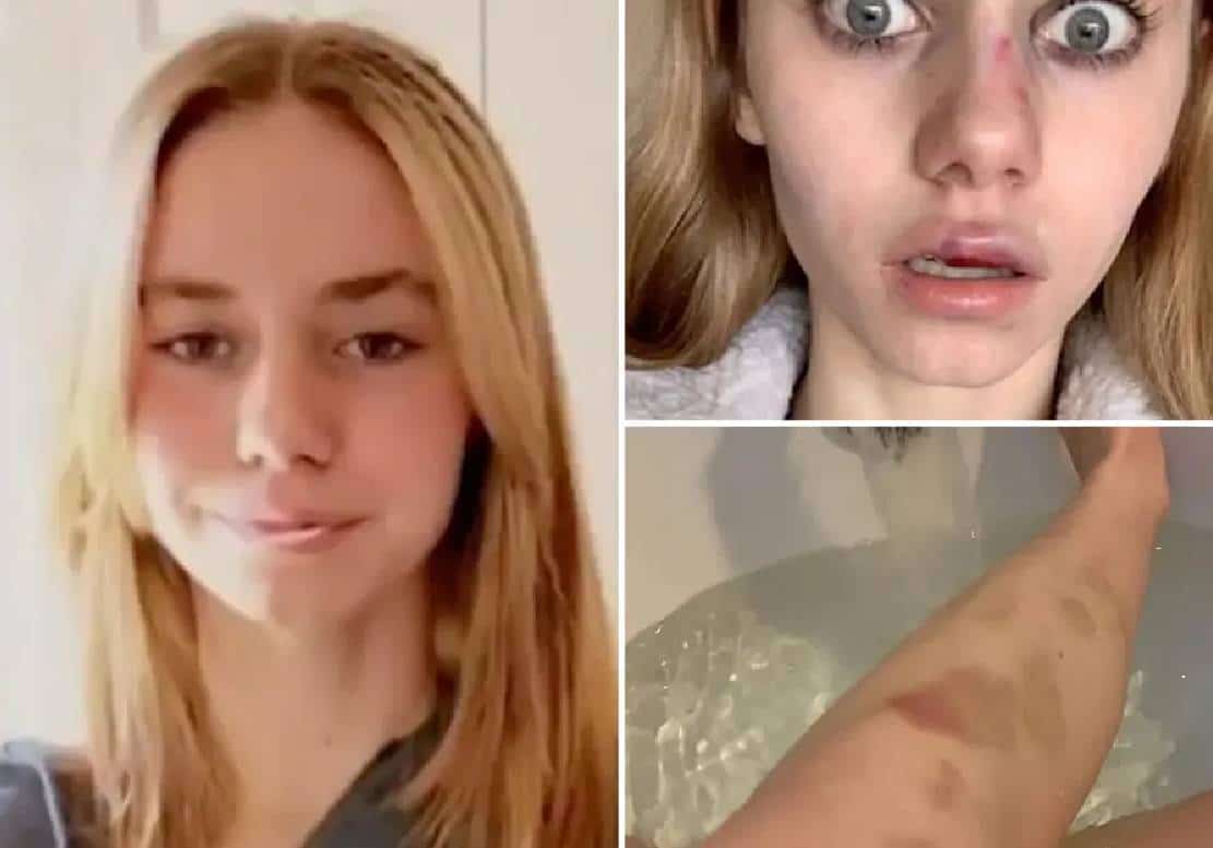 התעללות עד המוות: נערה בת 14 נטלה את חייה לאחר שסרטון בו היא עוברת התעללות הפך ויראלי בתום שנים של בריונות