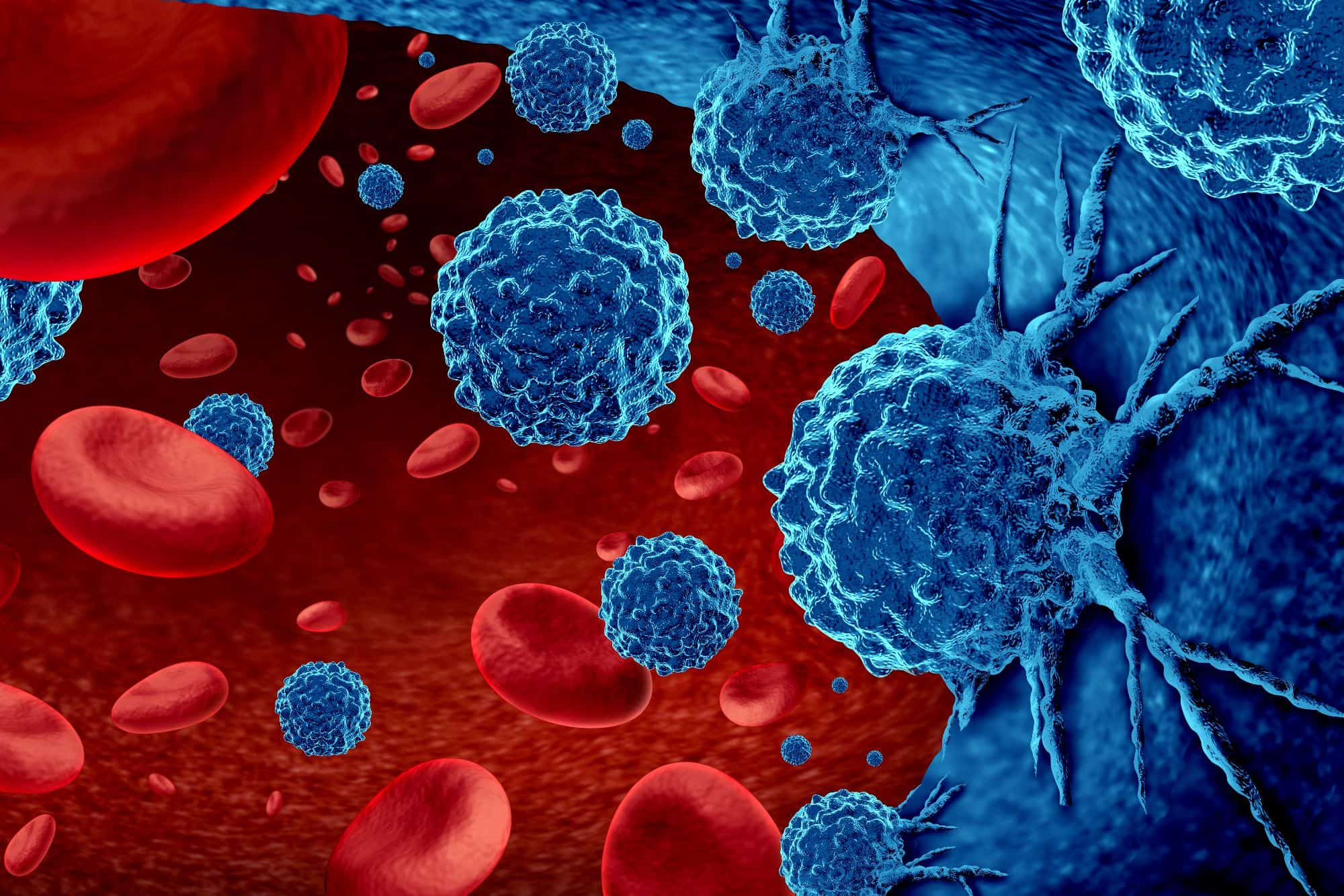 פריצת דרך היסטורית: "הגביע הקדוש' של גילוי הסרטן נמצא - בדיקת דם פשוטה שמנבאת גידולים שנה לפני שהם נוצרים