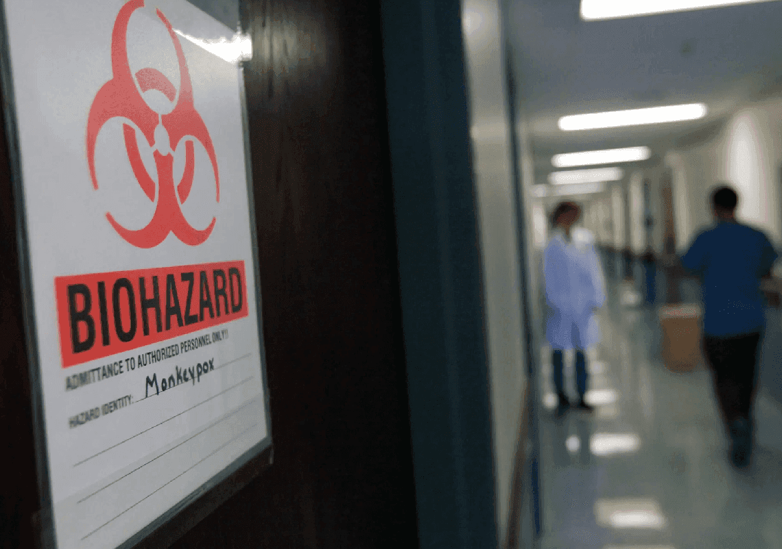 מקרה ראשון של אבעבועות קופים זוהה בארה"ב אצל גבר שחזר מקנדה