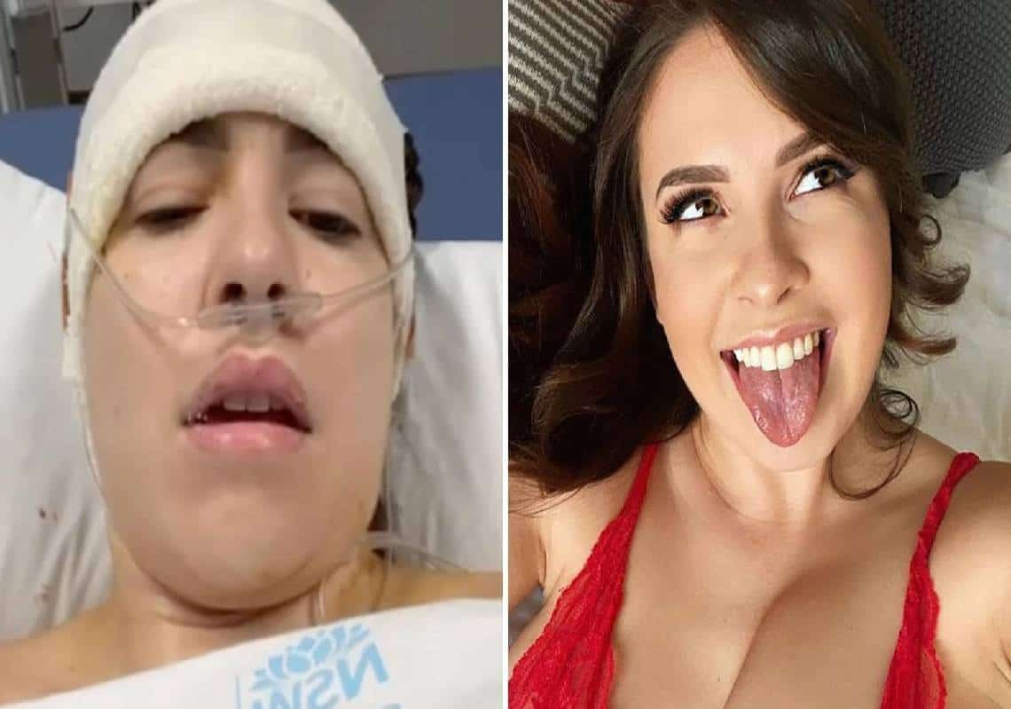 דוגמנית 'OnlyFans' עברה ניתוח מוח אך המשיכה להצטלם בעירום עבור מעריציה ממיטת בית החולים