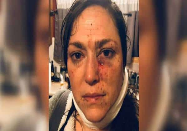 פליט סומלי תקף באכזריות את שכנתו: המשטרה טיפלה במקרה באופן מקומם במיוחד