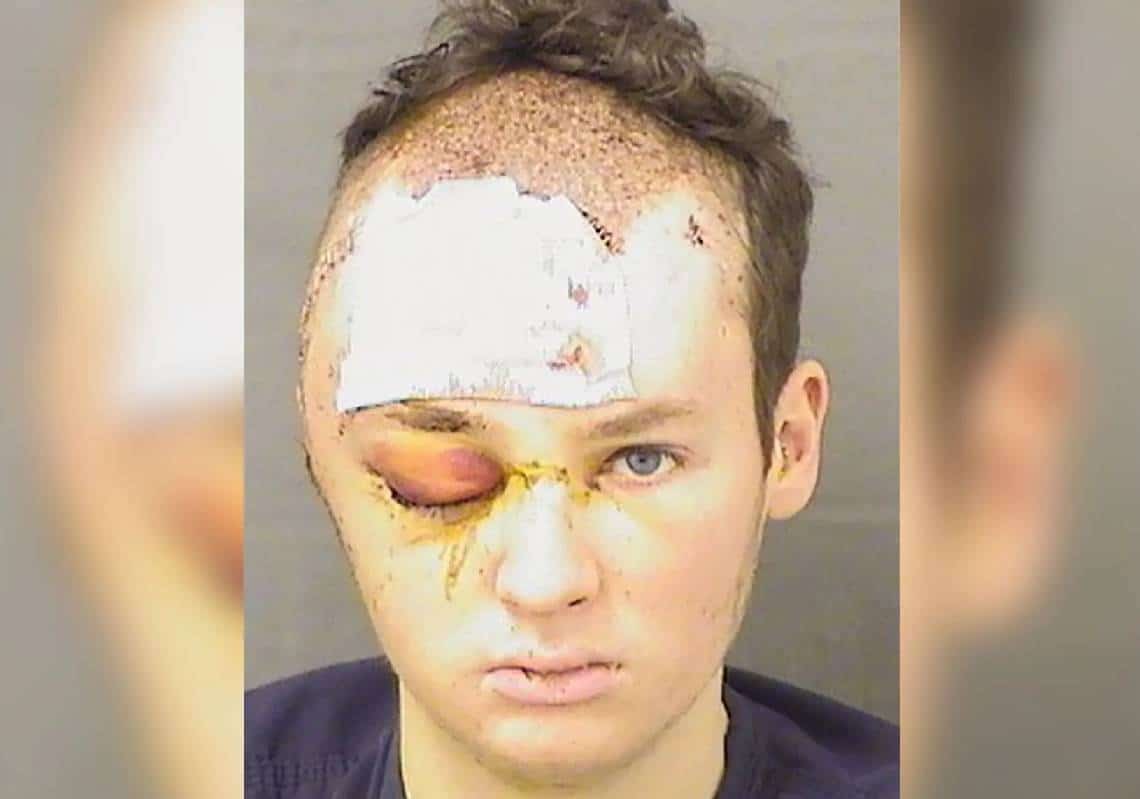 בחור הישיבה הפך למפלצת: צעיר יהודי חשוד באונס אכזרי ומתמשך של פסיכולוגית שלקח כבת ערובה, נורה בראשו ע"י המשטרה