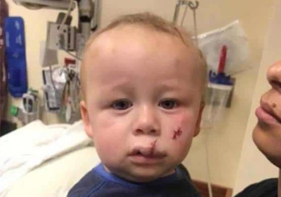 איווה: פעוט נפגע מכטב"ם בזמן ששיחק בגן שעשועים