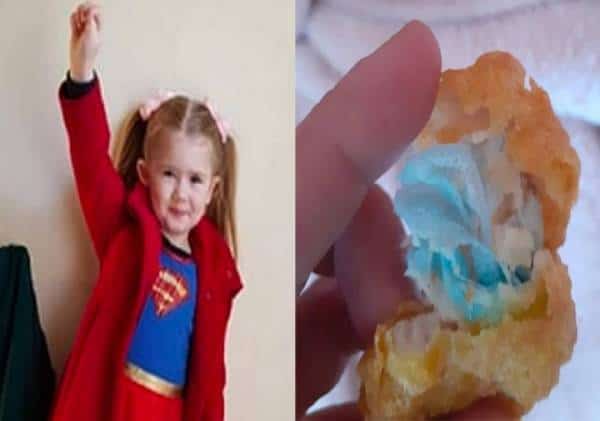 ילדה בת 6 כמעט נחנקה למוות ממסכה שהוכנסה בצ'יקן נאגט