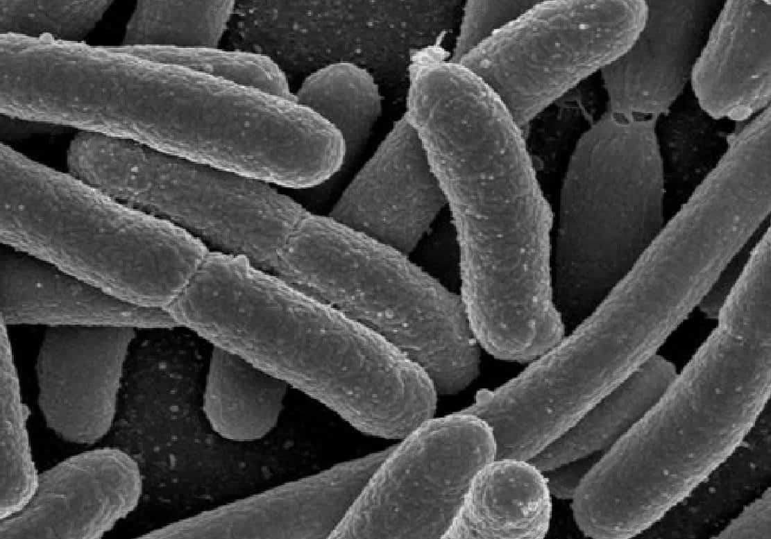 וירוס בטן עמיד באנטיביוטיקה מתפשט בכל רחבי ארה"ב 