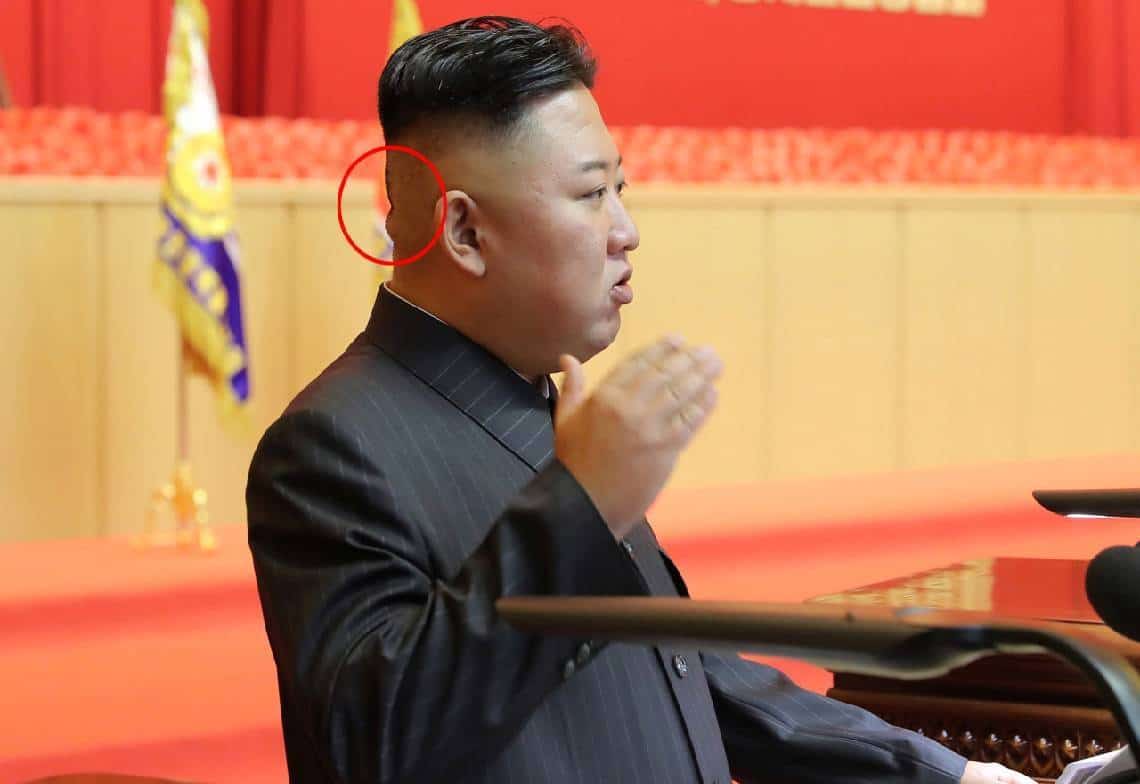 "מדבקה מסתורית מאחורי הגולגולת": גורמי ביון תוהים האם משהו לא בסדר אצל קים?