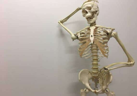 ניו יורק: משפט רצח הפך למופע בידור כשאומן לחימה שבר לסת של שלד הדגמה