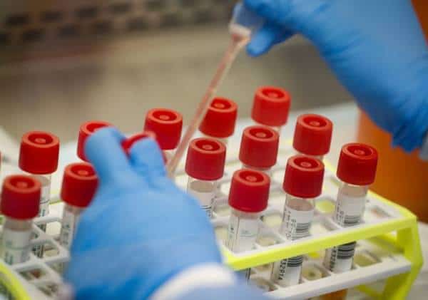 בצל הקורונה: מעבדות ברחבי ארה"ב מדווחות על מחסור עצום בציוד