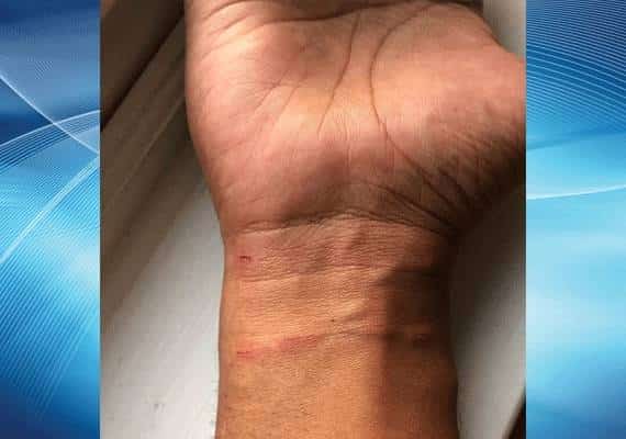 "עדיף למות מכלבת מאשר להיות בחוב שכזה": אדם נשרט על ידי חתול ונדהם בחדר המיון מהסכום שנדרש לשלם 