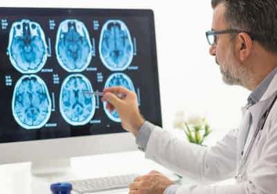 מחקר יפני חדש מגלה: טעמים מרירים כמו בקקאו וביין אדום מפעילים את המוח ומשפרים את הזיכרון