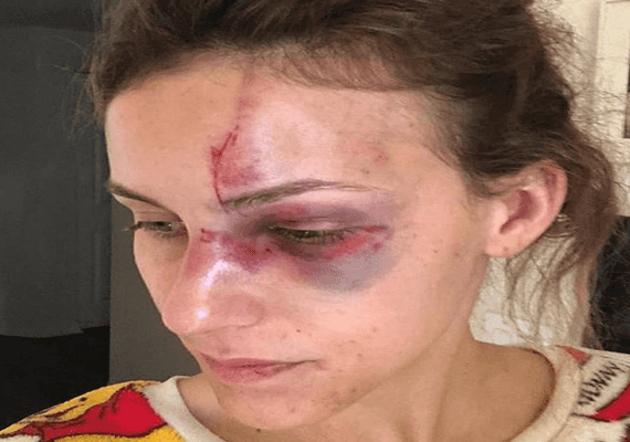 פלורידה: נעצר אלוף המוטוקרוס לאחר שהיכה את חברתו