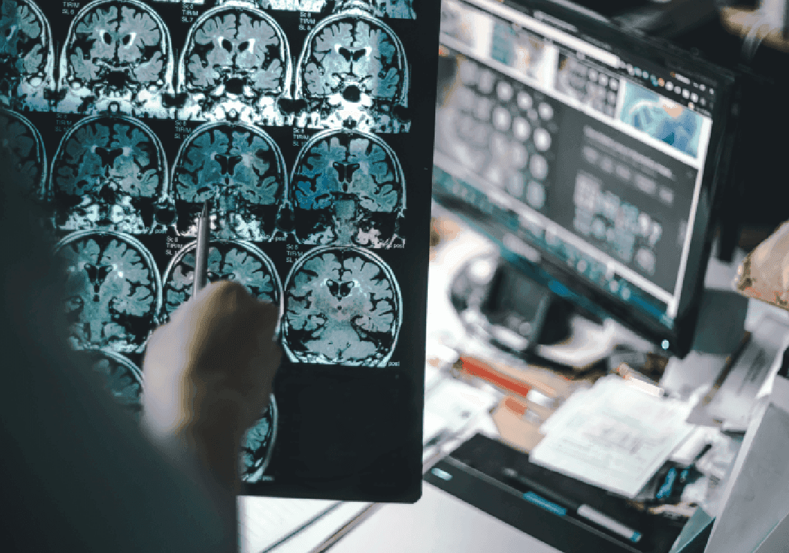 משרד הבריאות האמריקאי: גזענות מעלה את הסיכון לאלצהיימר