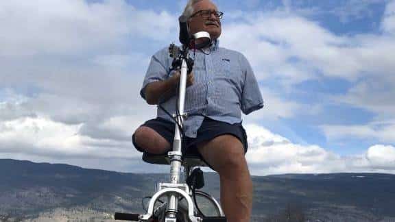 מקומם: יונייטד לא נתנה לקטוע רגל לעלות למטוס עם מכשיר ההתניידות שלו