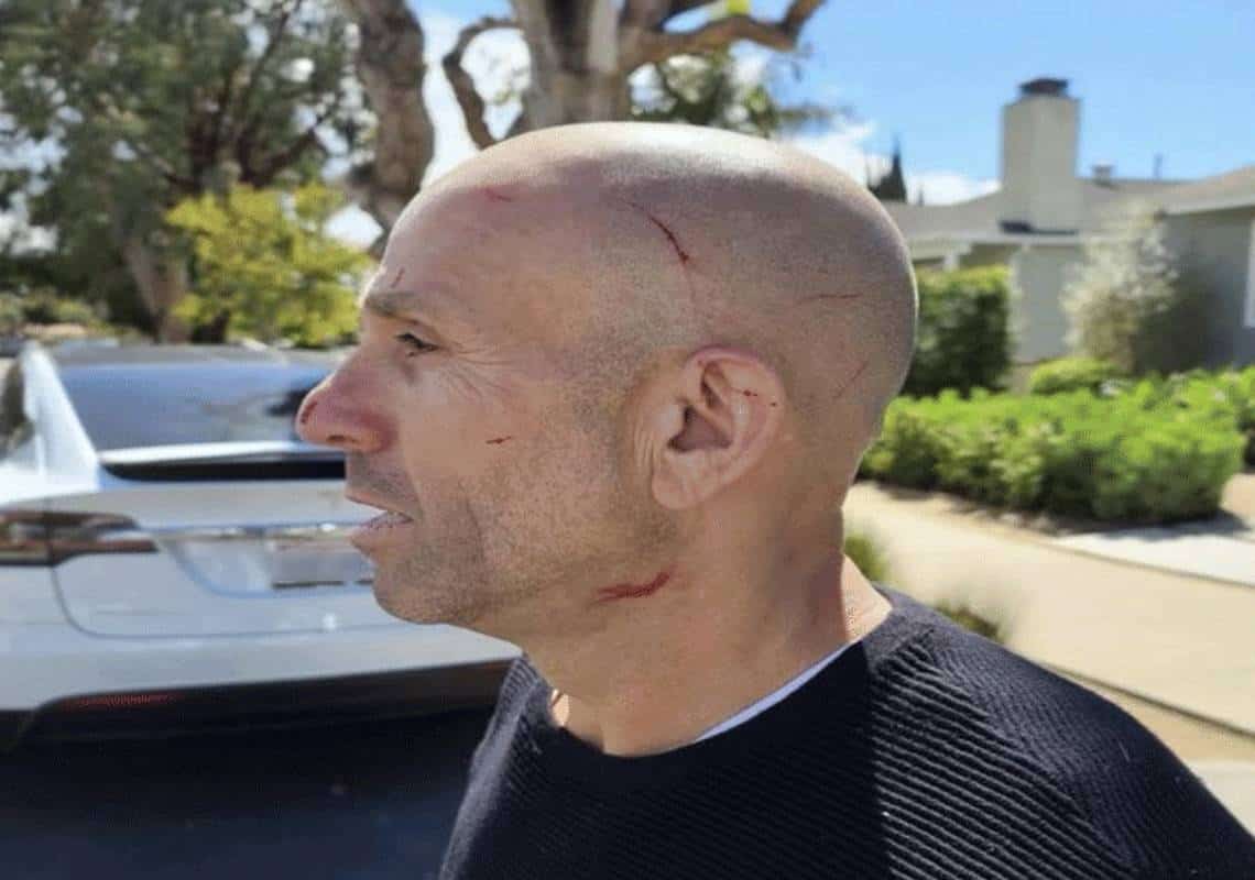 שוד לאור היום: סיילזמן ובעלי חברת הום אימפרובנט ישראלים יצאו מפגישה אצל לקוח ומצאו עצמם מול אקדחים שלופים 