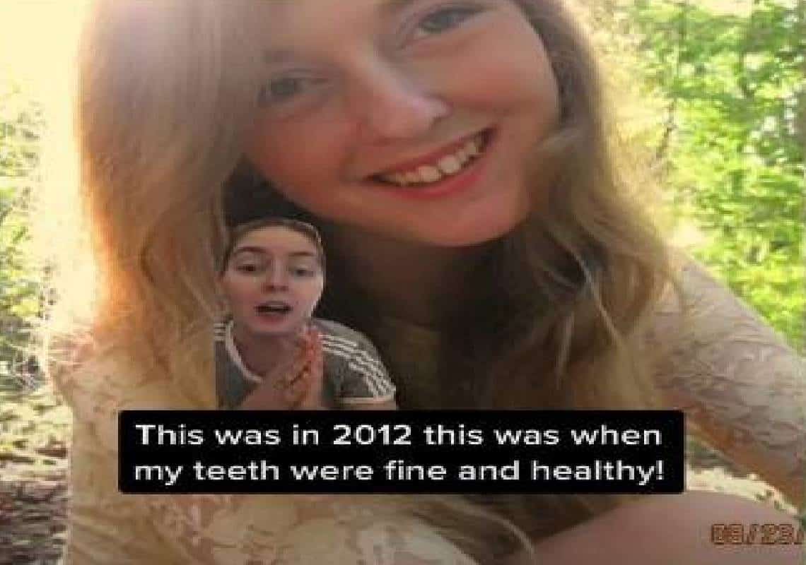  מפחיד: הצעירה היפהיפיה הזו אהבה משקאות ממותקים - בסוף זה עלה לה ביוקר - "שימרו על השיניים שלכם"