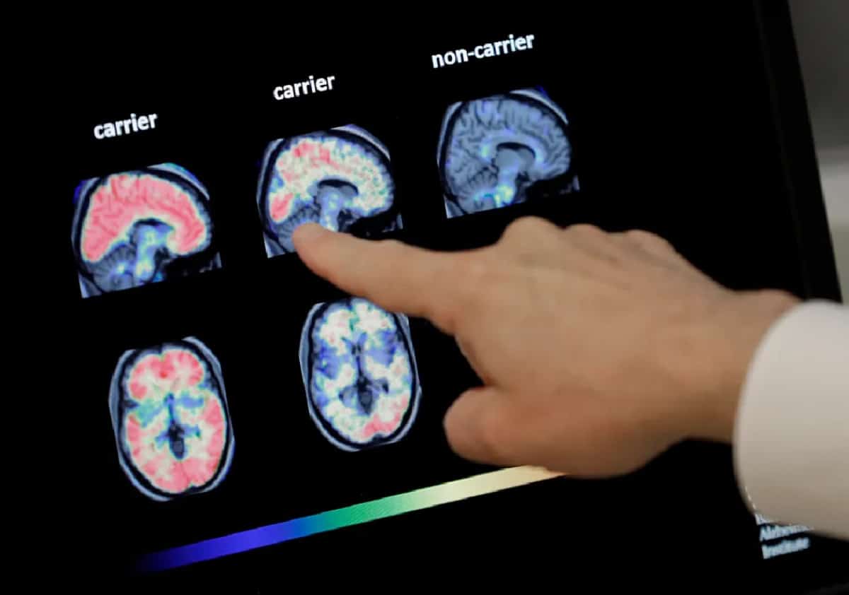 חוקרים קובעים: הרגל יומי שמקטין באופן משמעותי את הסיכון לאלצהיימר